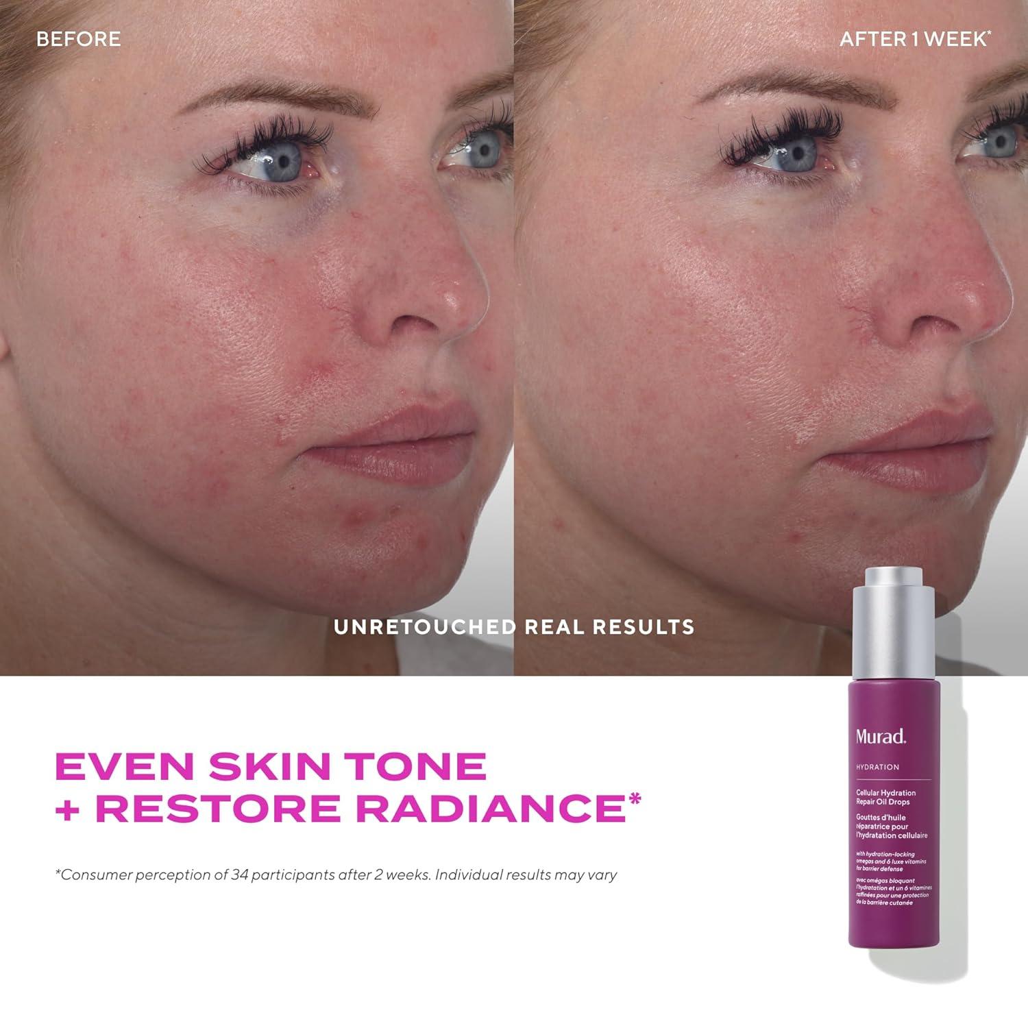 imageMurad Cellular Hydration Repair Oil Drops Hydrating Facial Oil for Dry Dehydrated Skin Strengthens Skin Barrier Boosts Radiance ampamp Smoothness Lightweight FastAbsorbing Formula 10 oz