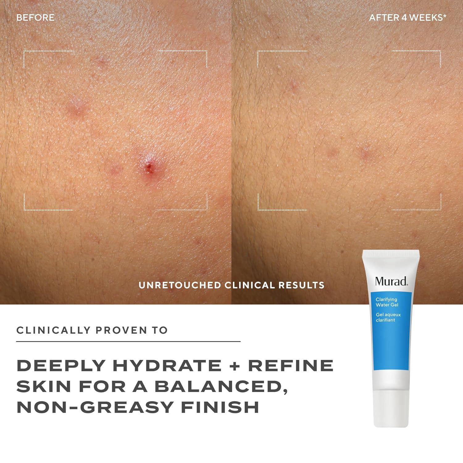 imageMurad Clarifying Water GelMulticoloured