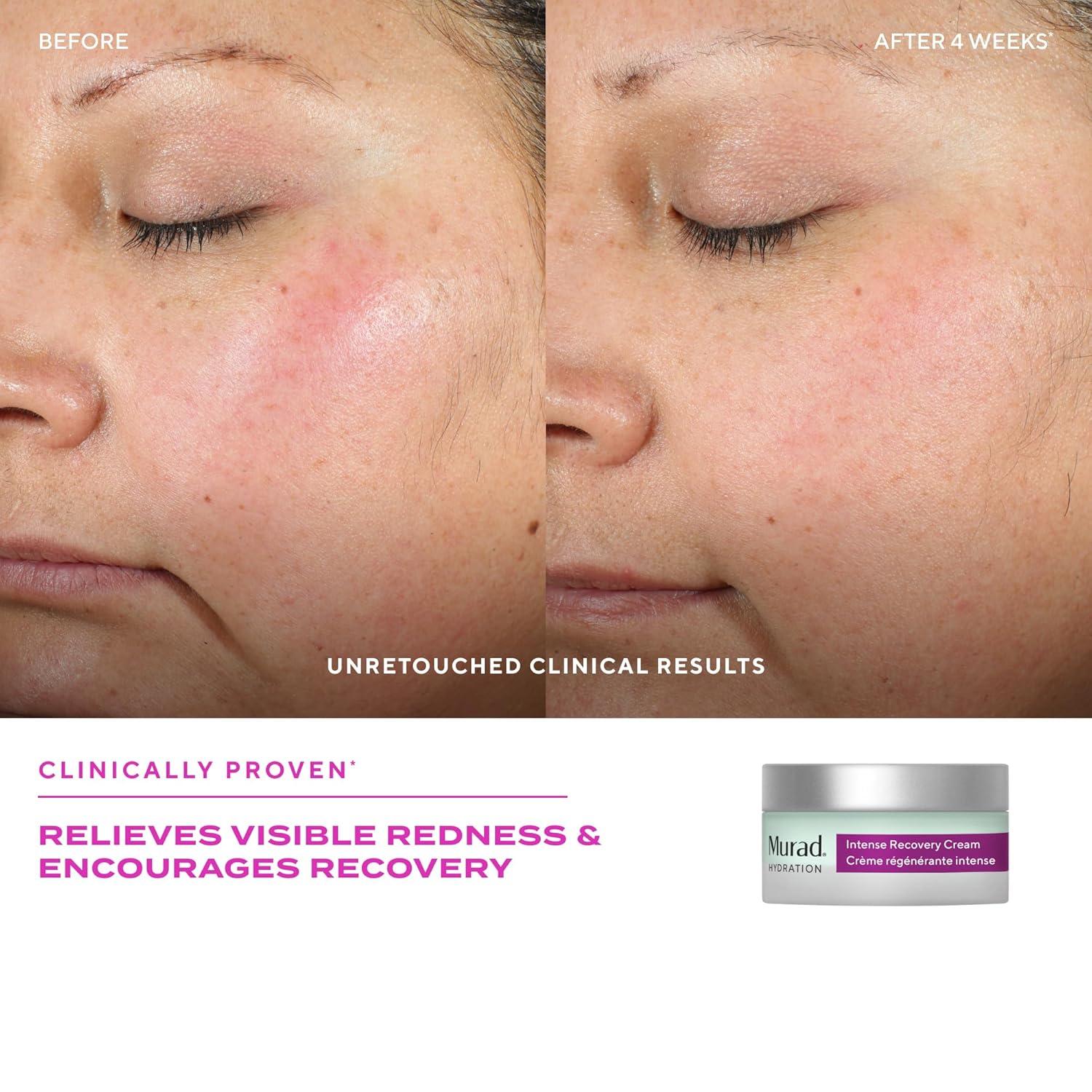 imageMurad Intense Recovery Cream Shea Butter Mirabilis Jalapa and Microalgae Face ampamp Eye Cream to Soothe Redness and Treat Severely Dry Stressed Aging and Damaged Skin 17 Fl Oz