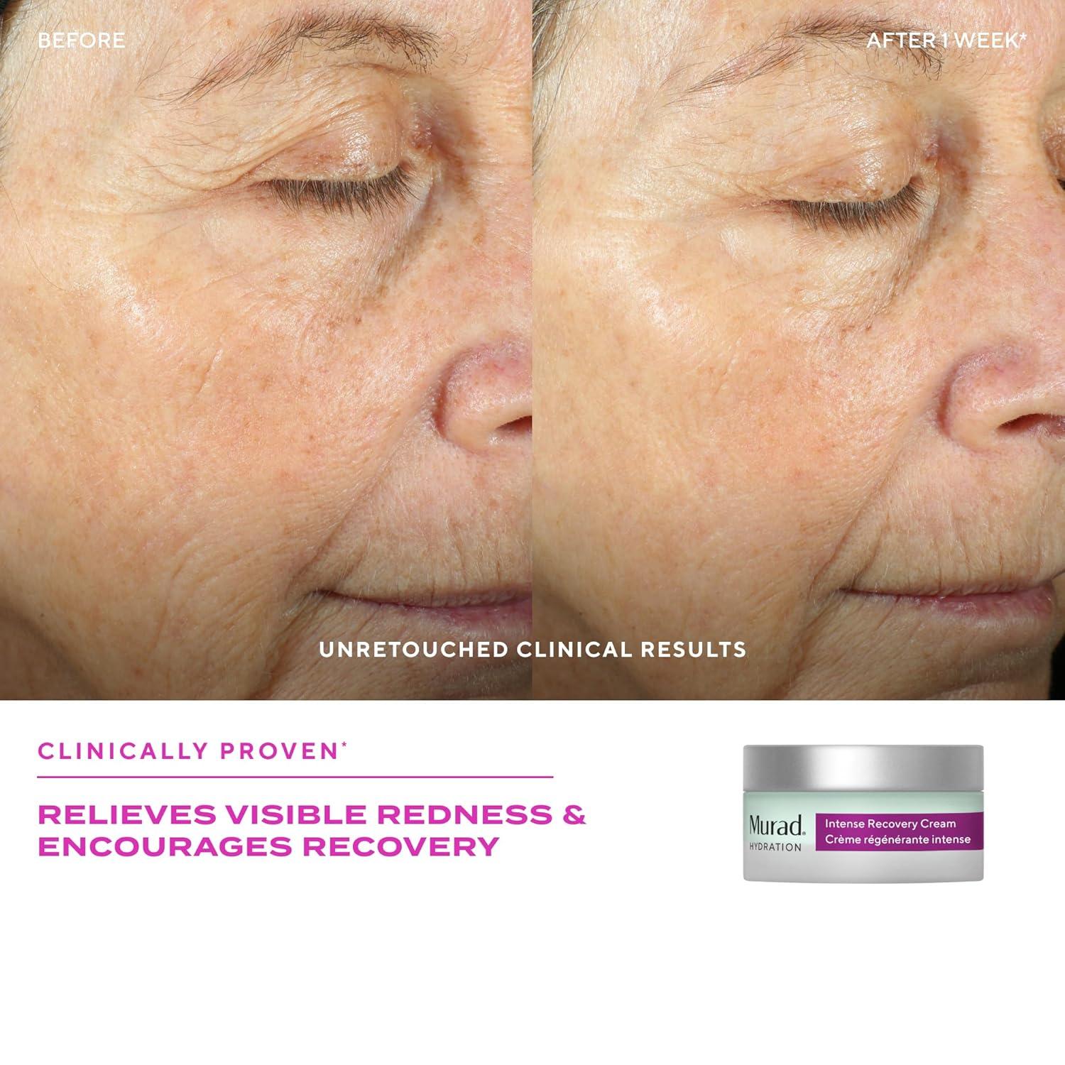 imageMurad Intense Recovery Cream Shea Butter Mirabilis Jalapa and Microalgae Face ampamp Eye Cream to Soothe Redness and Treat Severely Dry Stressed Aging and Damaged Skin 17 Fl Oz