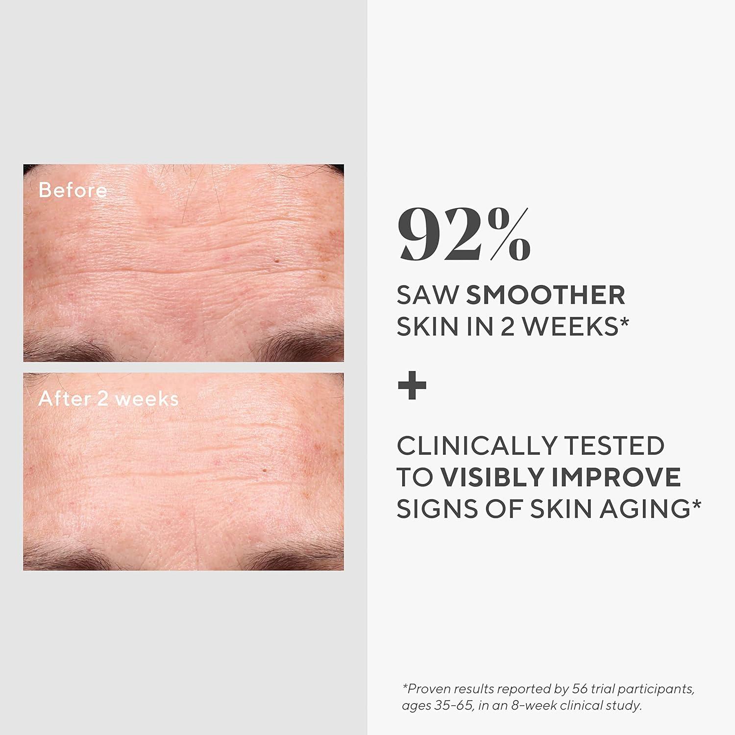 imageMurad Radiance ampamp Renewal Duo Dark Spot Correcting Serum Retinol Youth Renewal Serum for Brighter Smoother Firmer Skin Backed by Science