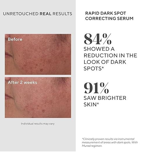 imageMurad Rapid Dark Spot Correcting Serum Advanced AntiAging Formula with Patented Resorcinol Technology Tranexamic and Glycolic Acids for Hyperpigmentation Dark Spots and Dull Skin 1 Fl Oz