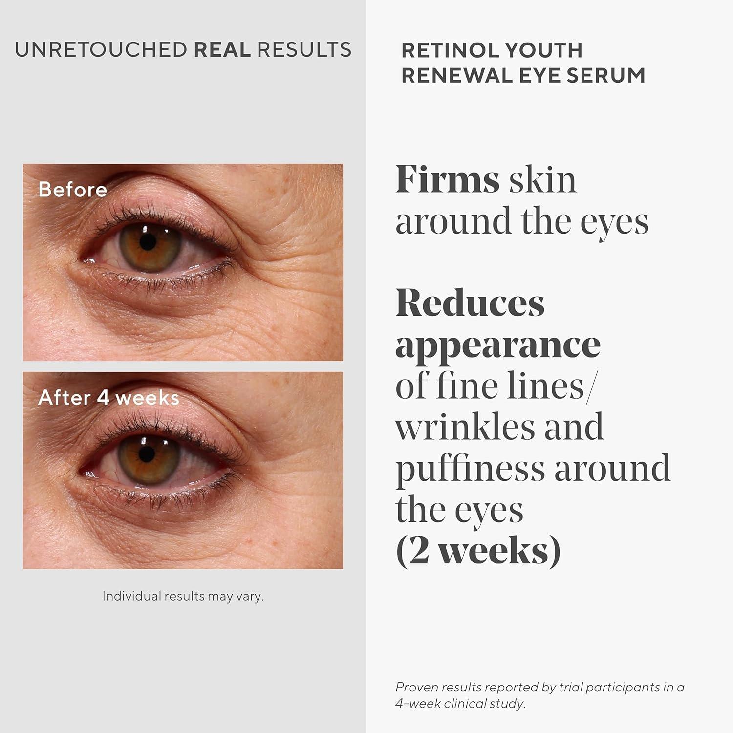imageMurad Retinol Youth Renewal Eye Serum Retinol Eye Serum Visibly Improves Undereye Puffiness Dark Circles and Reduces the Appearance of Fine Lines Gentle Enough for Nightly Use 05 oz