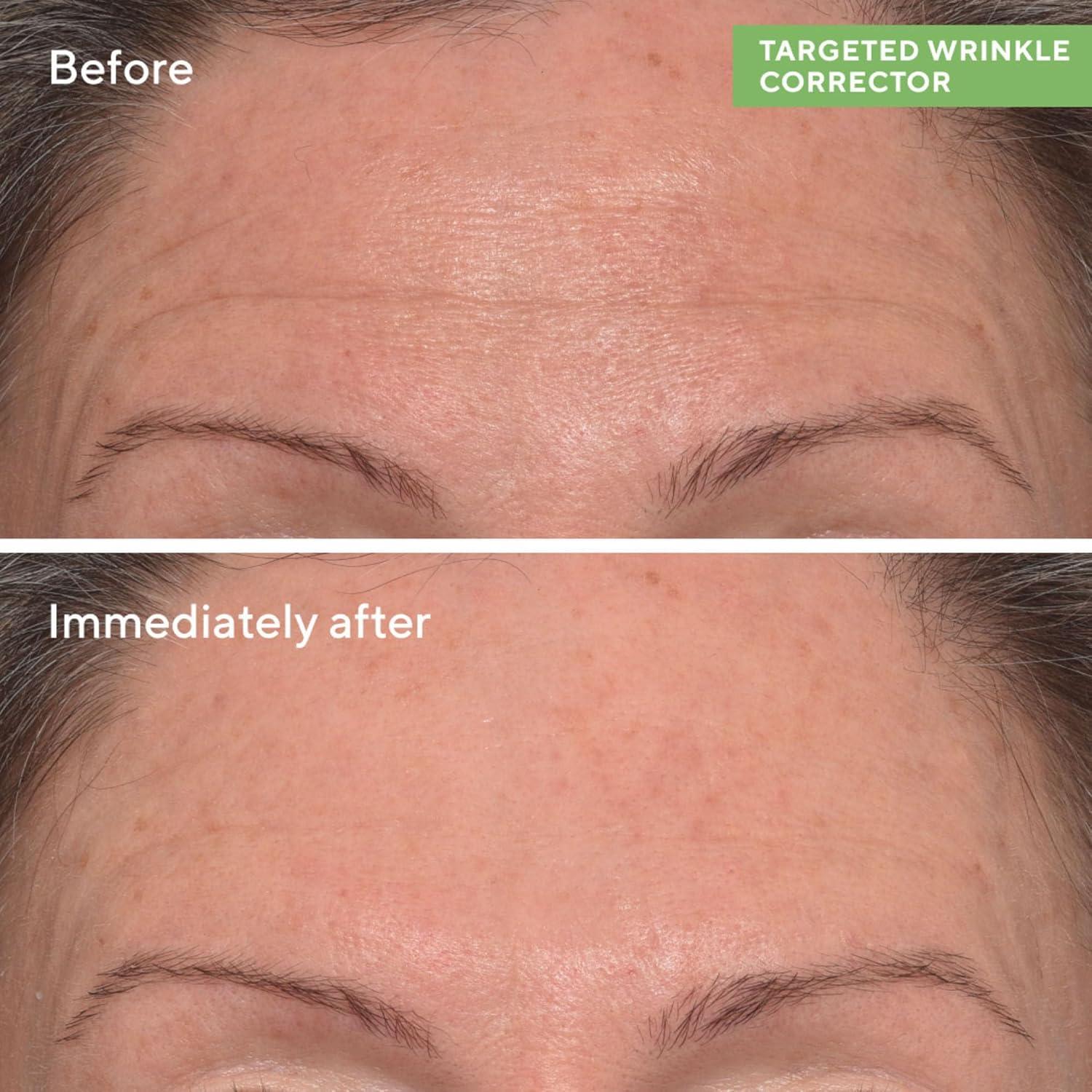 imageMurad Targeted Wrinkle Corrector Hyaluronic Acid and Peptide AntiAging Cream for Reducing Wrinkles Instant Plumping Smoothing and Hydrating Fine Lines 05 Oz