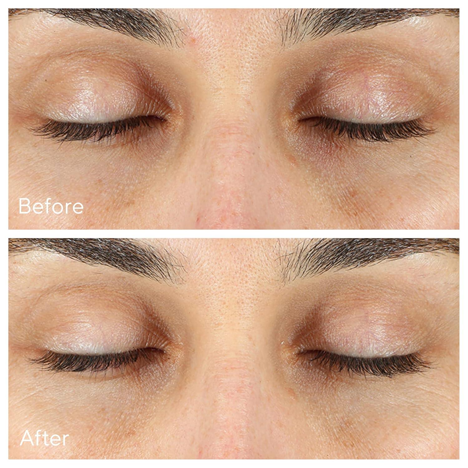 imageMurad VitaC Eyes Dark Circle CorrectorMulticoloured