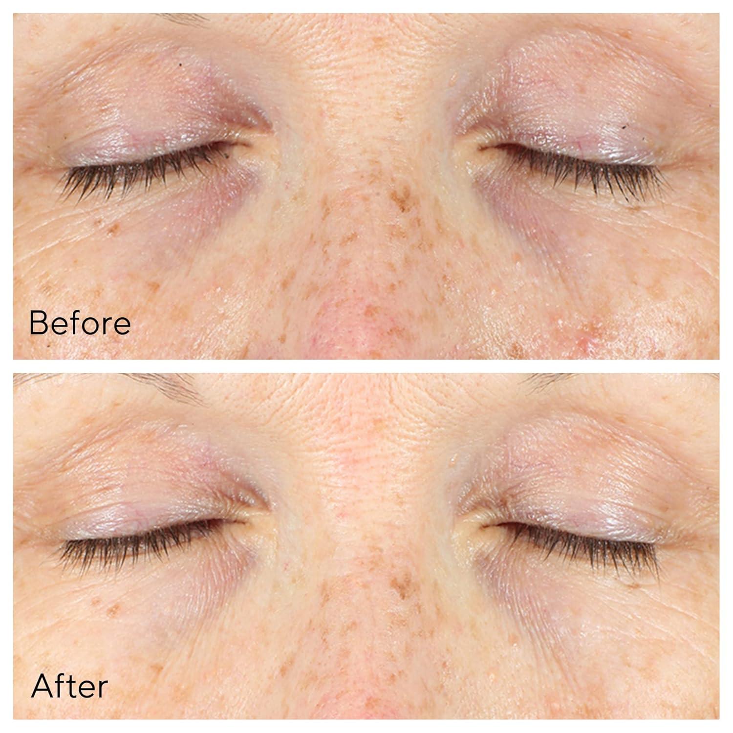 imageMurad VitaC Eyes Dark Circle CorrectorMulticoloured