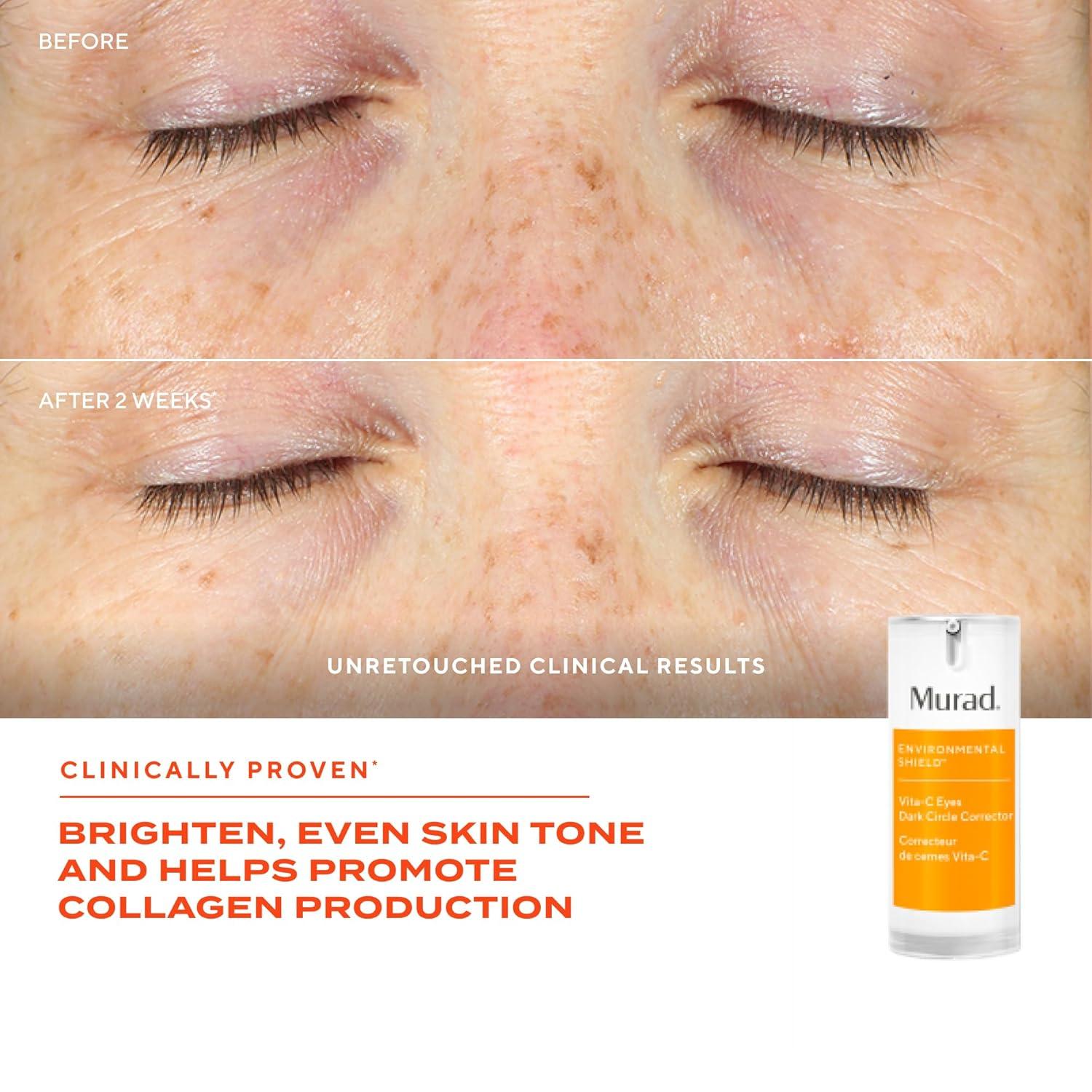 imageMurad VitaC Eyes Dark Circle CorrectorMulticoloured