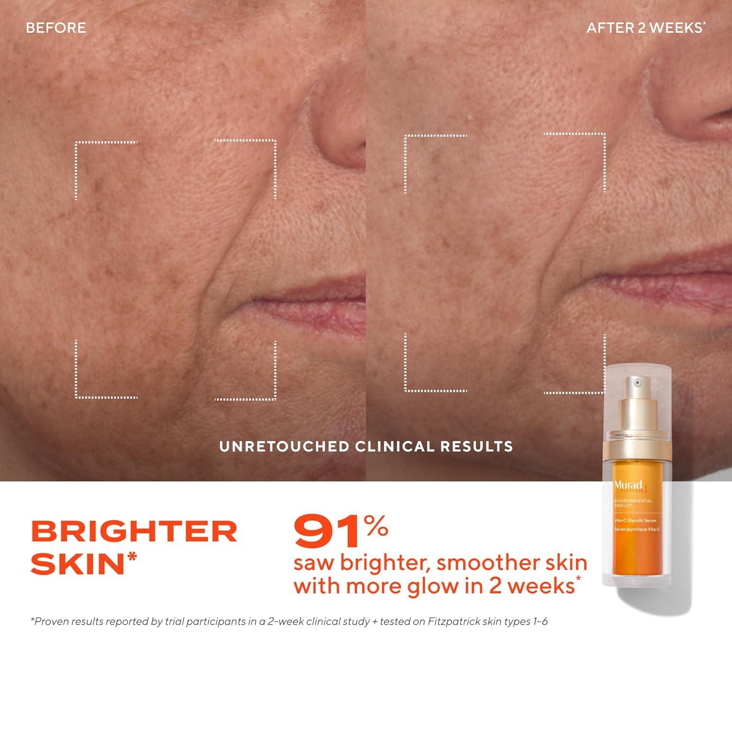 imageMurad VitaC Glycolic Serum Advanced Brightening Vitamin C and Glycolic Acid Face Serum for Improved Skin Tone and Texture GoldStabilized Vitamin C for Enhanced Efficacy and Potency1 Fl Oz Pack of 1