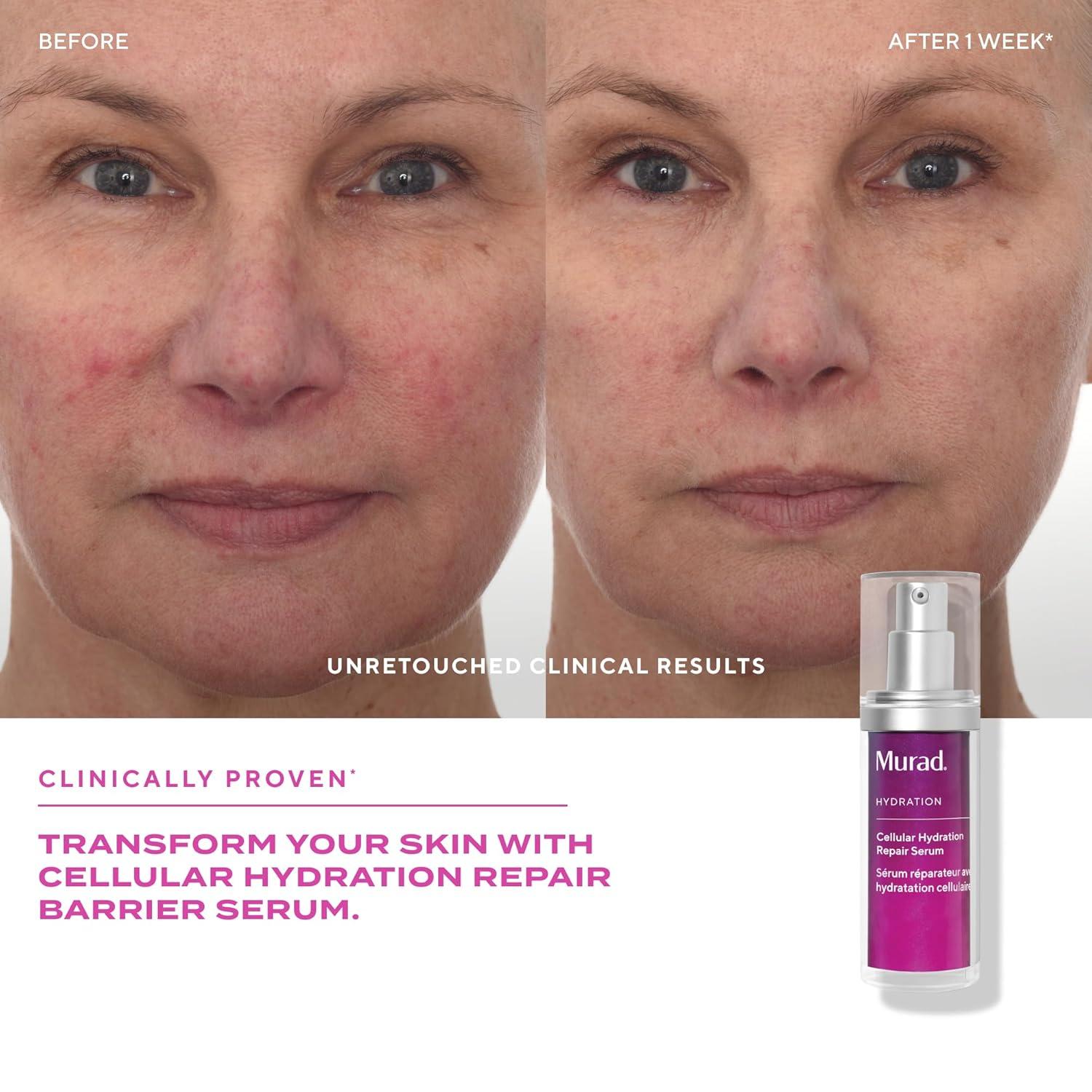 imageMurad Cellular Hydration Barrier Repair Serum Hydrating Face Serum Repairs LipidDepleted Skin Barrier Hexapeptide9 Bilberry and Hyaluronic Acid Delivers Stronger Healthier Skin1 Fl Oz Pack of 1