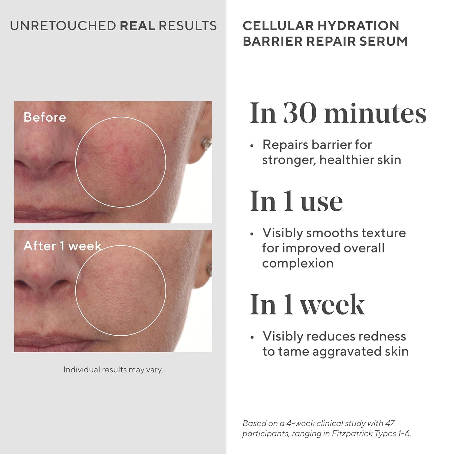 imageMurad Cellular Hydration Barrier Repair Serum Hydrating Face Serum Repairs LipidDepleted Skin Barrier Hexapeptide9 Bilberry and Hyaluronic Acid Delivers Stronger Healthier Skin1 Ounce Pack of 1