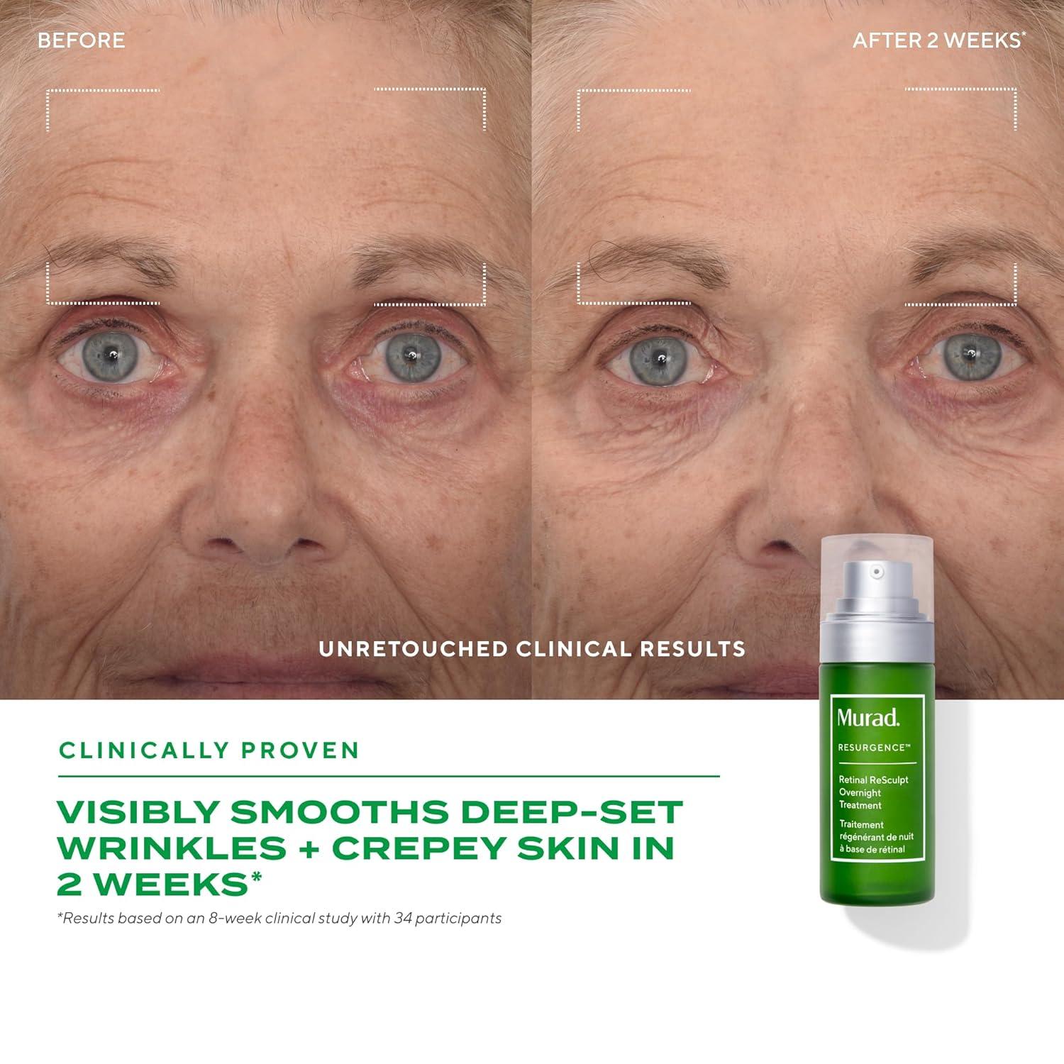 imageMurad Retinal ReSculpt Overnight Treatment Advanced Face and Neck Serum with Encapsulated Retinal Kangaroo Paw Olive ampamp Oat Smooths Deep Wrinkles and Crepey Skin ampamp Lifts Sagging Skin1 Fl Oz Pack of 1