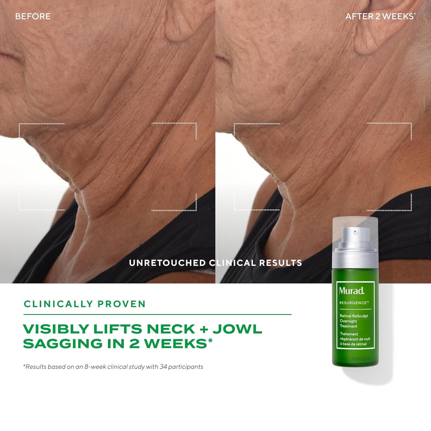 imageMurad Retinal ReSculpt Overnight Treatment Advanced Face and Neck Serum with Encapsulated Retinal Kangaroo Paw Olive ampamp Oat Smooths Deep Wrinkles and Crepey Skin ampamp Lifts Sagging Skin1 Fl Oz Pack of 1