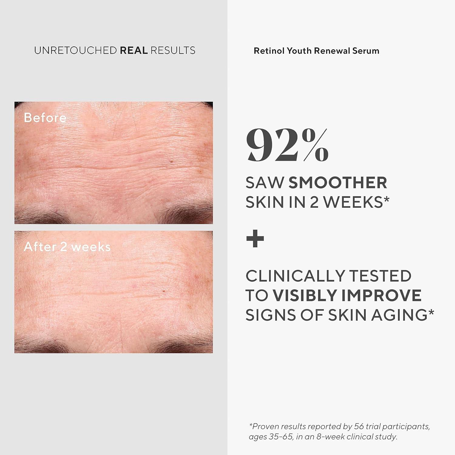 imageMurad Retinal Trial Kit Lift and Resculpt with Retinal 2Piece Trial Kit 73 Value AntiAging Set Encapsulated Retinal Retinal Serum 05Fl Oz Retinal Eye Cream 011Fl Oz1 Fl Oz Pack of 1