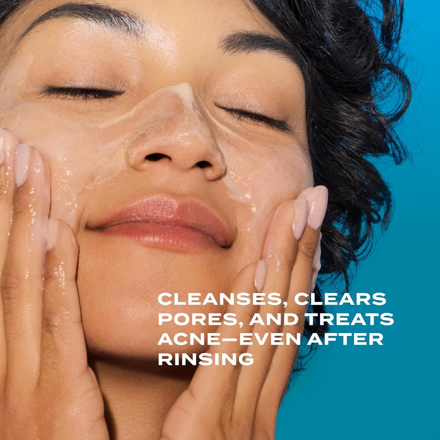 image:imageMurad Acne Control Clarifying Cleanser Salicylic Acid amp Green Tea Formula for Acne Deep Pore Cleansing Oil Control amp Breakout Prevention for Clear Balanced HealthyLooking Skin5 Fl Oz Pack of 1